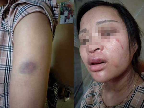 Mẹ thai phụ 8 tháng bị chồng đánh dã man vì mua giày 135 ngàn: 'Cháu ngoại tôi sắp chào đời, nó cần có bố bên cạnh'