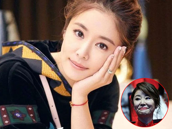 Lâm Tâm Như thắng kiện hàng trăm triệu vì bị công ty thẩm mỹ sử dụng trái phép bức ảnh xấu 'ma chê quỷ hờn' để quảng cáo