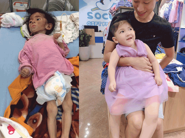 Bất ngờ với 'cơ thể mới' của cô bé gầy trơ xương Thào Thị Yến Nhi ngày nào, sau khi được mẹ nuôi nhận về chăm sóc suốt 3 năm