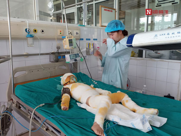 Vụ cô giáo đốt cồn dạy phòng chống cháy nổ: Nghẹn ngào lời kể của người mẹ trẻ