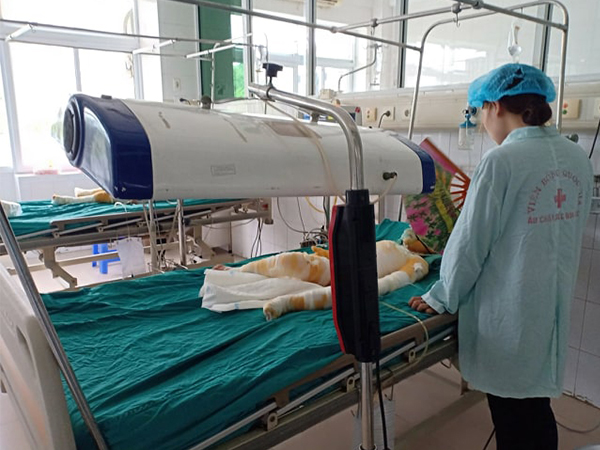 Vụ cô giáo mầm non đốt cồn dạy chống cháy nổ: 3 cháu bé bỏng nặng vẫn nguy kịch