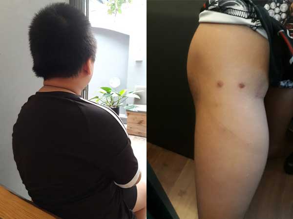 Nghi án bố cùng dì ghẻ bạo hành con trai dã man suốt nhiều năm ở Phú Thọ: Đốt túi bóng nhỏ vào mông, bắt nhặt cơm dưới đất lên ăn