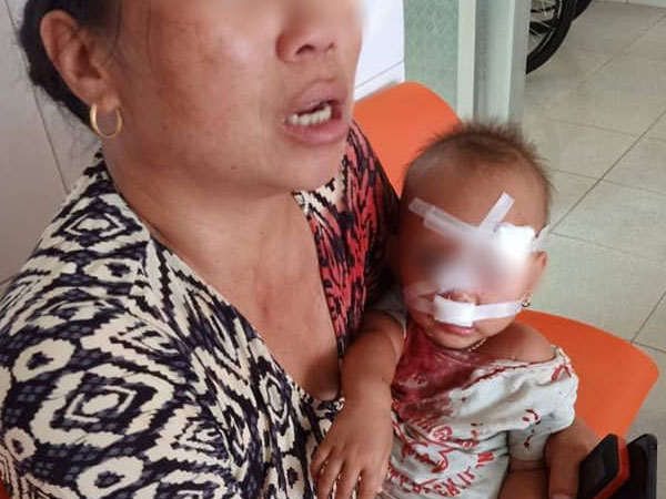 Bé gái 2 tuổi mặt mũi đầy máu được mẹ bế đi cấp cứu, nghi do bố ruột bạo hành