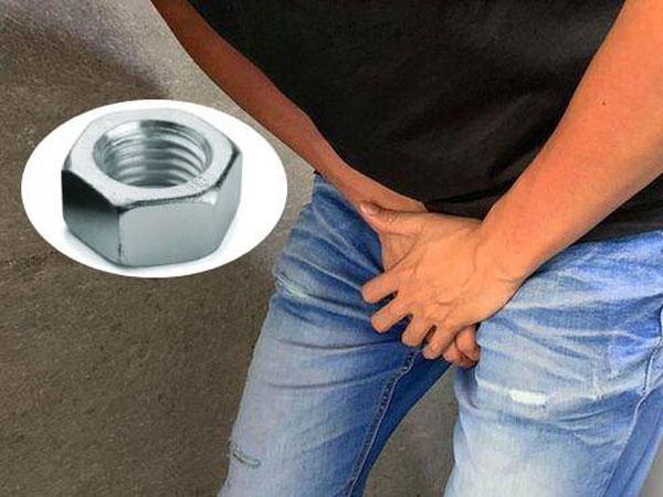 Tai nạn phòng the khiến bác sĩ cũng phải 'vã mồ hôi': Mắc kẹt vì dùng đai ốc để thủ dâm và hàng loạt chiêu quái đản để tăng cực khoái của phái mạnh