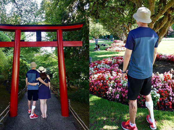 Việt kiều Canada sau 7 tháng bị cắt gân chân và tạt axit giờ ra sao?