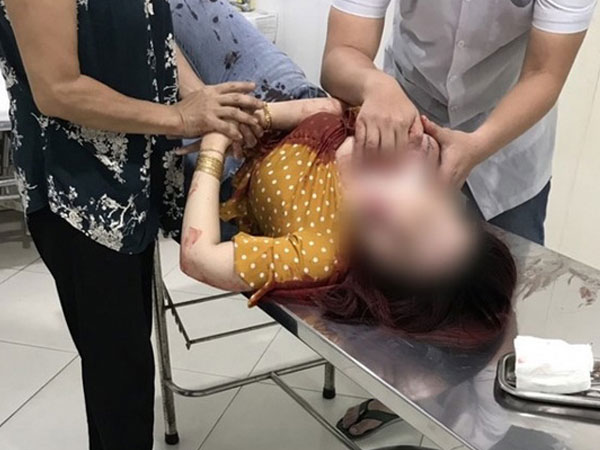 Bình Dương: Cô gái bị đối tượng đi xe SH dùng dao đâm nhiều nhát vào cổ, ngã gục xuống đường