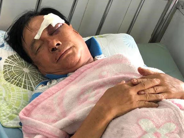 Mâu thuẫn việc tranh giành tài sản, con rể dùng chai bia đánh bố vợ nhập viện