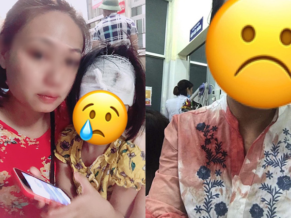 Chồng cầm chảo đánh vợ lúc cãi nhau, con gái hơn 3 tuổi bị vạ lây phải khâu 5 mũi khiến dân mạng xót xa