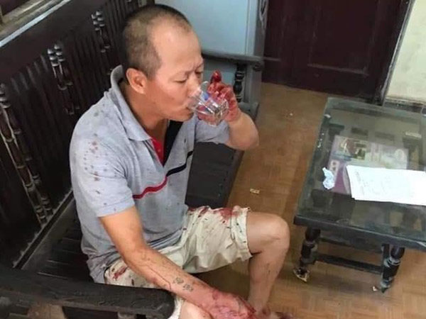 Đối tượng truy sát cả gia đình em trai khiến 5 người thương vong bình thản khi bị bắt: 'Mọi người ở lại mạnh khỏe tôi đi đây, dù sao cũng chết'