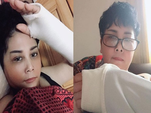 NSND Minh Hằng ngã gãy tay trong ngày Hà Nội mưa to gió lớn