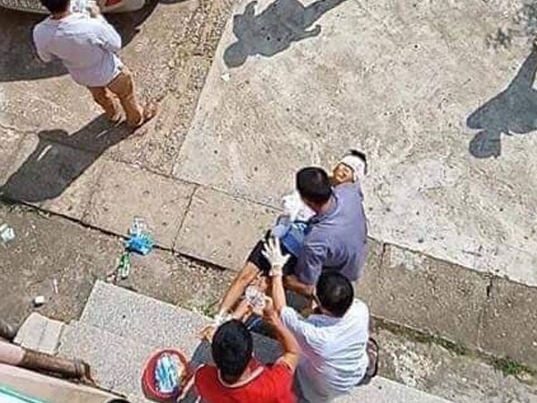 Xót xa bé trai bị bác ruột dùng dao chém đứt lìa tay khi đang nằm ở nhà
