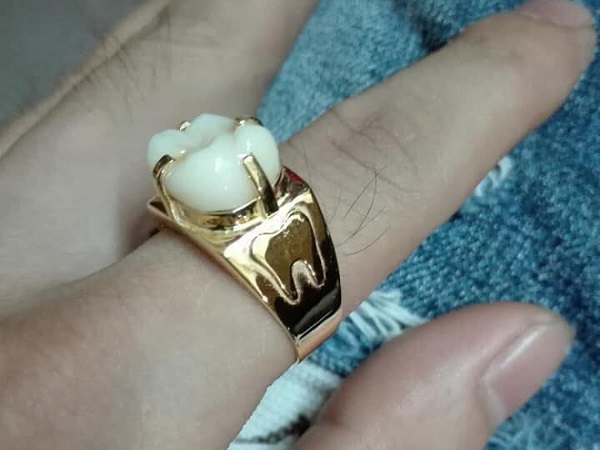 Người phụ nữ mang chiếc răng đi làm mặt nhẫn, câu chuyện đằng sau khiến nhiều người 'xanh mắt'