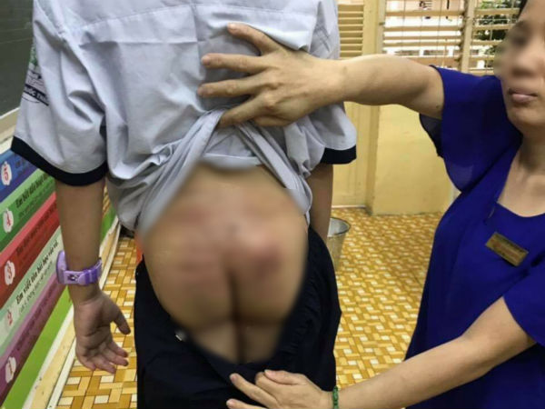 TP.HCM: Nghi án cha ruột bạo hành bé trai 10 tuổi thời gian dài tại chung cư
