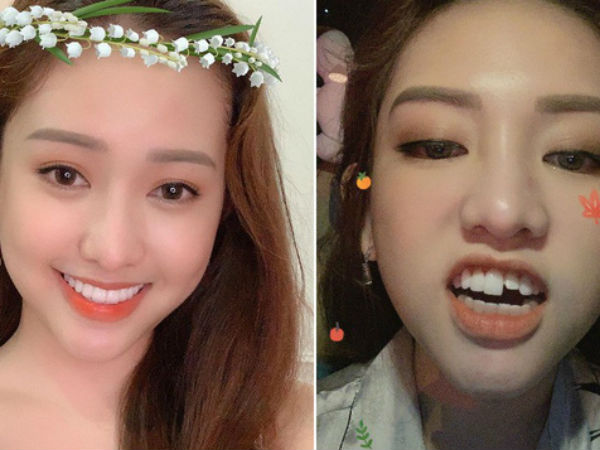 Cấm cười khi nghe 'drama' mới của Thúy Vi: Đi toilet té gãy răng cửa, chục 'củ' đi tong trong nháy mắt