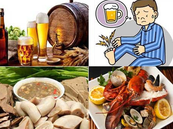 'Bệnh nhà giàu' đang có xu hướng 'nghèo, trẻ hoá': Bác sĩ chỉ những thói quen gây ra bệnh