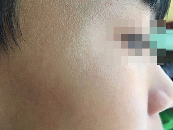 TP.HCM: Tài xế xe ôm công nghệ nghi hành hung học sinh lớp 9 dẫn đến chấn thương vì đứng sai điểm đón