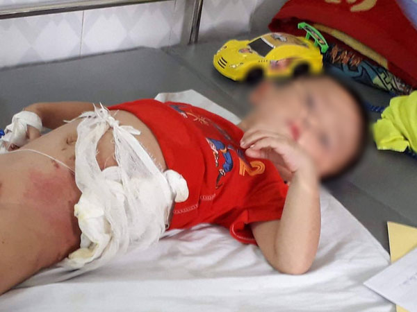 Thông tin sốc về người bác ruột ném cháu vào đống lửa vì tranh ăn dưa