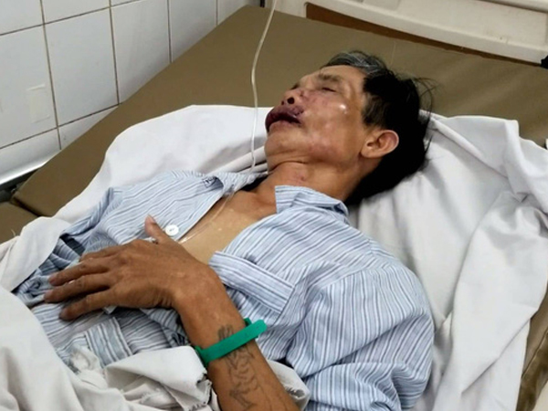 Phóng viên Tạp chí Luật sư Việt Nam bị đánh xuất huyết não