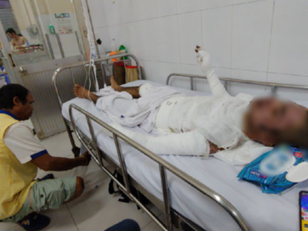 Bị vợ đuổi khỏi nhà, người chồng 23 tuổi quẫn trí mua xăng về tự thiêu khiến cơ thể bỏng nặng