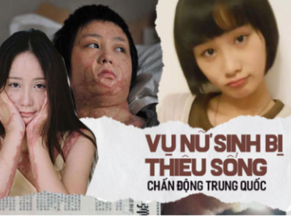 'Cả gan' cự tuyệt tình cảm của đại thiếu gia, nữ sinh xinh đẹp bị thiêu sống, hủy hoại cuộc đời, hung thủ lãnh án nhẹ nhàng nhờ gia thế khủng