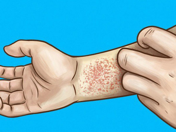 10 dấu hiệu cho thấy thận của bạn đang quá tải hoặc ngừng hoạt động