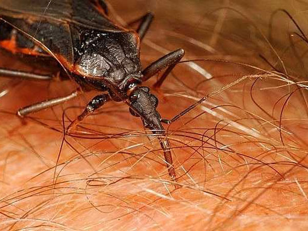 Bị bọ xít hút máu cắn, người đàn ông sốc phản vệ suýt chết