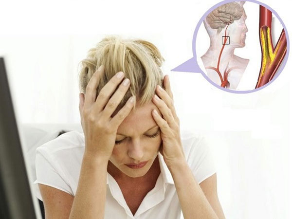 Vì sao nhiều người hay bị đau đầu khi thay đổi thời tiết?