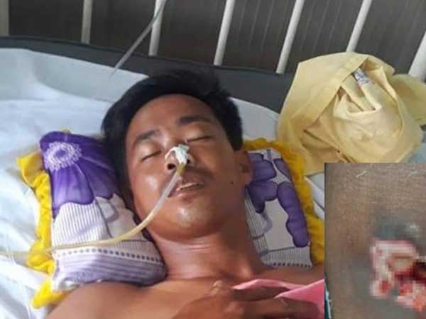 Đình chỉ công tác trưởng công an xã nghi 'cướp cò' súng làm bị thương thanh niên bắt chuột