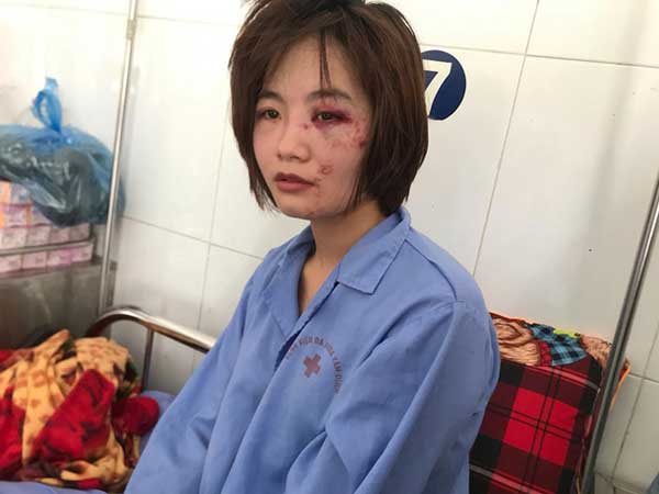 Nữ phụ xe buýt sợ hãi và tổn thương sau khi bị đánh hội đồng đến nhập viện: 'Bọn họ xuống xe còn bảo đánh thế vẫn còn nhẹ'