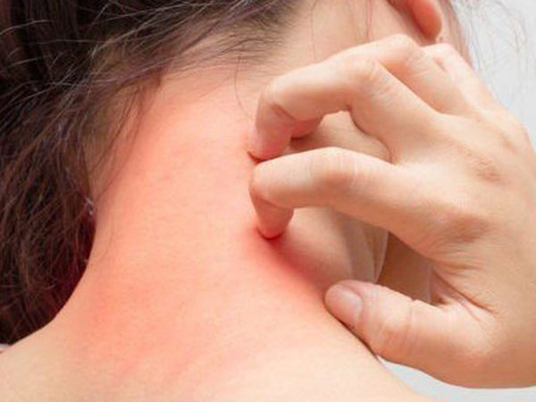 Ba mẹ con bị ngứa râm ran khắp người, đi khám phát hiện cùng mắc chung một loại bệnh