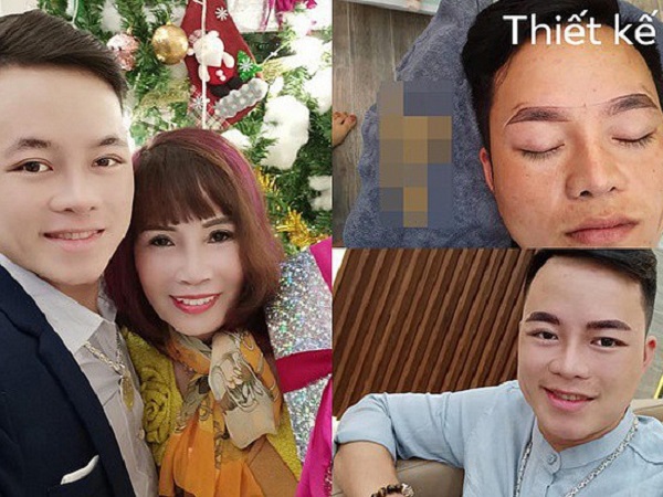 Chồng cô dâu 62 tuổi gây sốc với diện mạo mới sau khi được vợ 'chơi lớn' cho đi tân trang nhan sắc