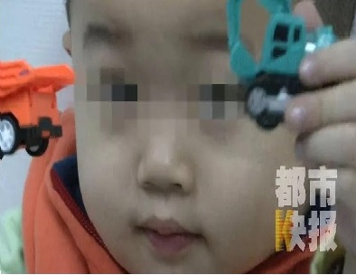 Bé trai 3 tuổi bị mù suốt 10 ngày chỉ vì bị cảm lạnh nhưng không điều trị dứt điểm