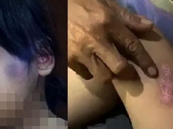 Chân dung gã cha dượng bạo hành dã man con gái riêng của vợ hờ