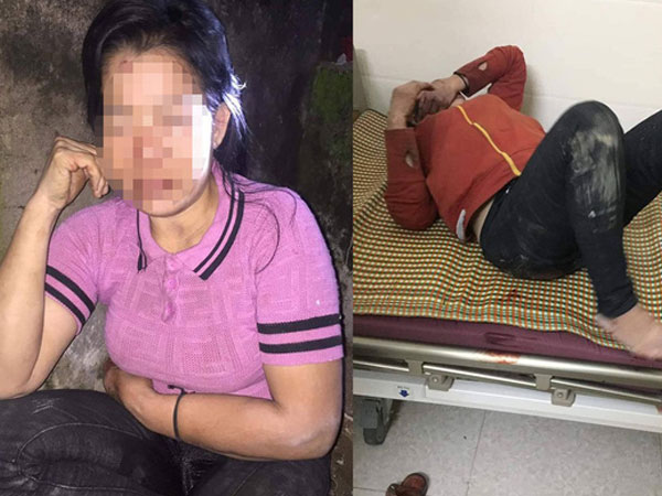 Một phụ nữ bị kẻ lạ đánh đập dã man vào vùng kín trong đêm