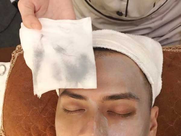 Phương pháp làm đẹp hút chì thải độc da: Chuyên gia tiết lộ sự thật khiến chị em nào cũng sốc và tiếc tiền hùi hụi