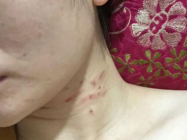 Người phụ nữ nghi bị chồng đánh đập kêu cứu cộng đồng mạng: 'Xin ai đó hãy báo công an giúp'
