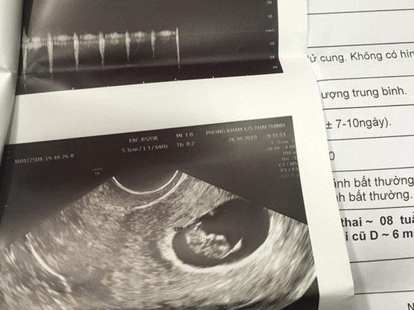 Vụ người vợ 28 tuổi hút mỡ bụng xong mới biết có thai: Bác sĩ thực hiện phẫu thuật sử dụng chứng chỉ giả