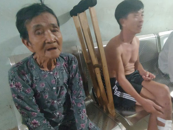 Phẫn nộ bà cụ bị gã thanh niên tạt cháo lên đầu, lừa lấy mất 23 triệu đồng vay để mổ chân cho con