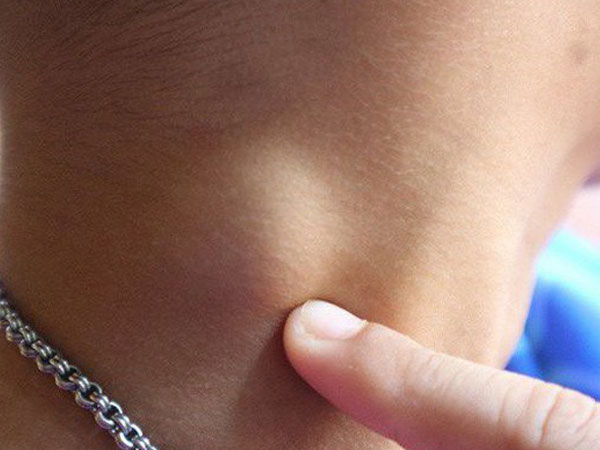 Ung thư tiến triển là do chậm đi khám: Nếu có 3 bộ phận này lồi lên thì cần vào viện ngay