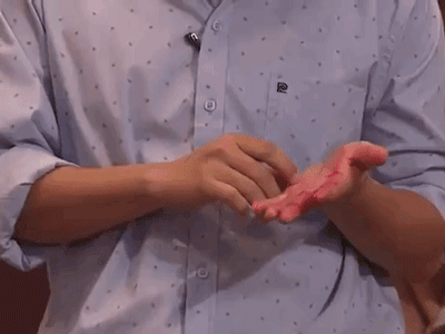 Trường Giang gặp sự cố bất ngờ, máu chảy đầm đìa trên sân khấu khiến khán giả xót thương