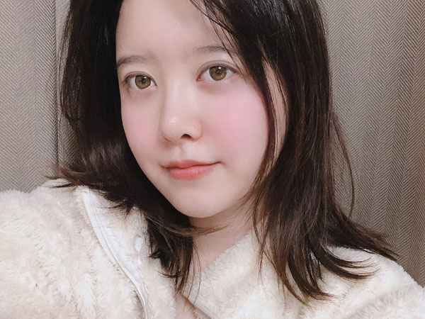 Goo Hye Sun xuất hiện khác lạ với gương mặt sưng vù
