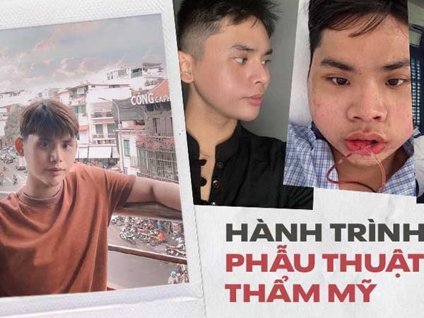 Hành trình lột xác ngoạn mục của chàng trai chi 200 triệu cho 5 lần 'dao kéo', nhiều lần phải đấu tranh '1 là đẹp hơn, 2 là chết'