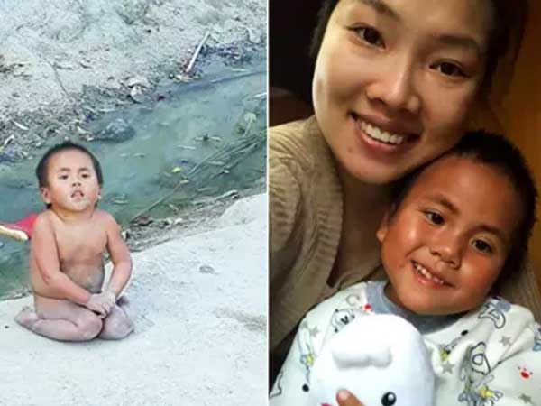 Cuộc sống của 2 em bé dân tộc được nhận nuôi khi mang bệnh bây giờ ra sao?