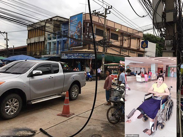 Bị dây điện 22.000 Volt rơi trúng người, người phụ nữ may mắn sống sót
