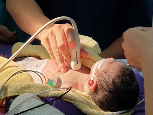Bé sơ sinh 1 ngày tuổi bị bệnh tim bẩm sinh phức tạp, bác sĩ phải phá vách liên nhĩ để cứu sống bé
