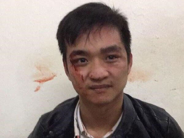 Bắt giữ đối tượng cướp tiệm vàng rồi bỏ chạy ở Hà Nội