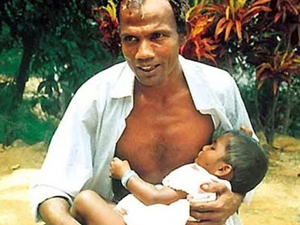 Giải mã hiện tượng người đàn ông có sữa