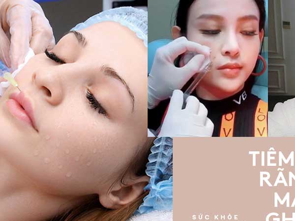 Nhiều người gặp biến chứng do tiêm filler trẻ hóa khuôn mặt, chuyên gia đưa ra khuyến cáo cực quan trọng mà ai cũng cần biết