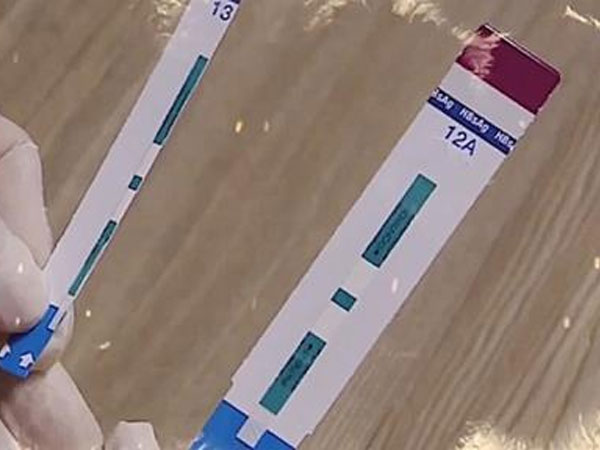 Cắt đôi que thử HIV ở Xanh Pôn: Lây truyền 'căn bệnh thế kỷ' kiểu mới