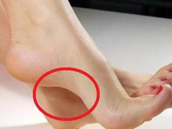Ngó bàn chân vài giây, biết ngay dấu hiệu 'đại tài' dự báo sắp giàu to, cứ đi một bước là tiền kéo về